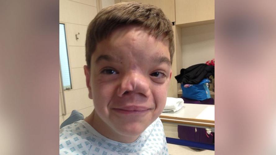 这位军人初遇脸部畸形男孩时就答应会帮他,接下来13年的变化让人看哭