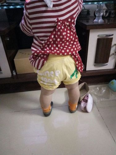 宝宝一周岁o型腿咋办?