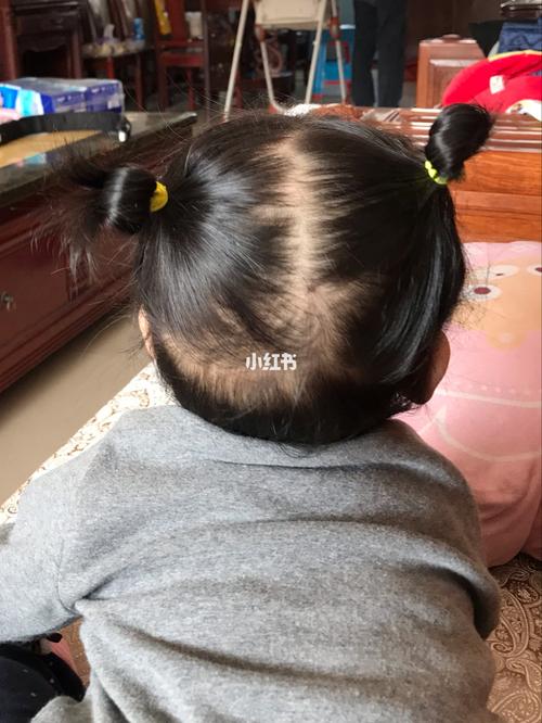 九个月能扎丸子头