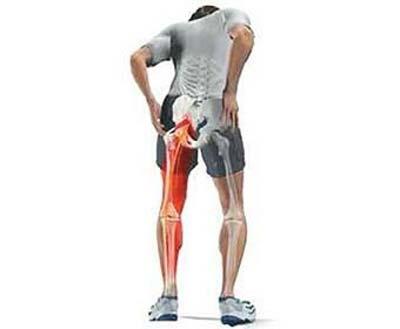 髋关节疼痛的原因