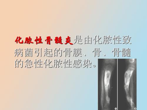 化脓性骨髓炎病人的护理