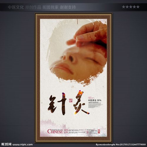 针灸图片