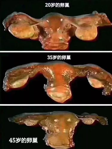 给你看看真实的卵巢对比.