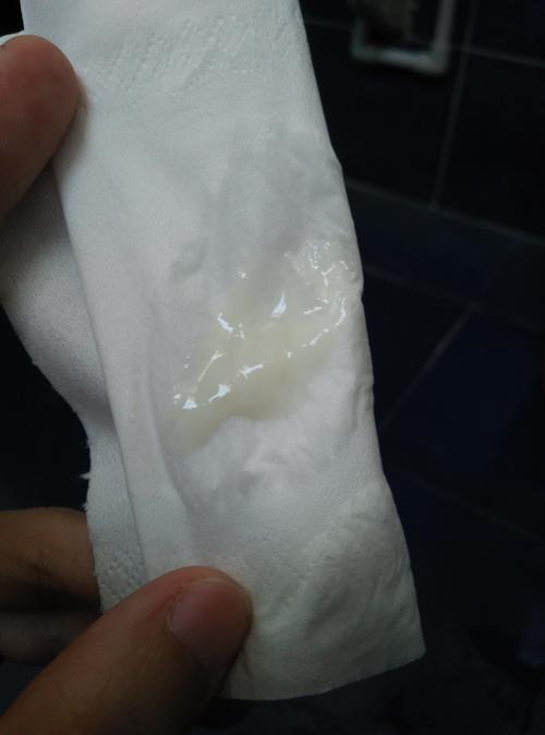 排卵期的白带,这样算正常吗?