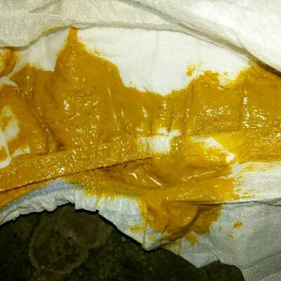 宝宝五十八天了,拉这样的大便是不是拉肚子了?喷射出来的