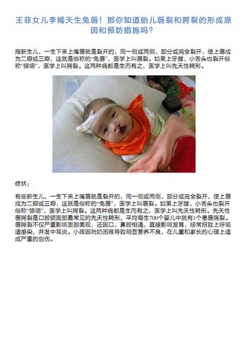 那你知道胎儿唇裂跟腭裂的形成