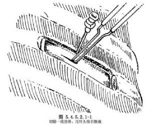  p>肺脓疡引流术是作为急救手术,避免 a href="#" data-lemmaid="