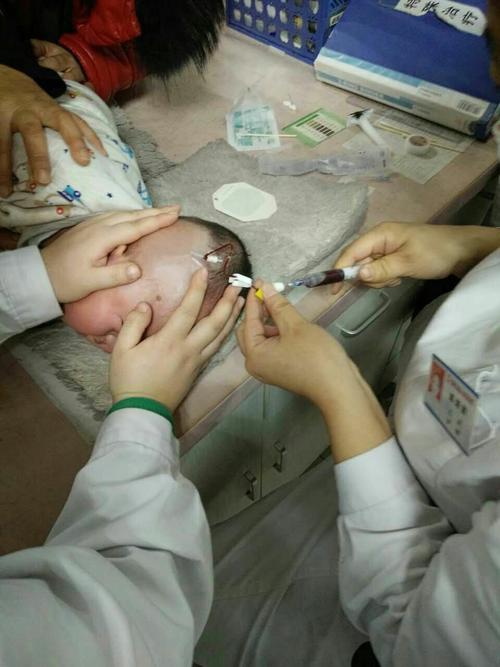 小儿头静脉穿刺抽血技术