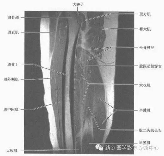 大腿解剖 详细标注