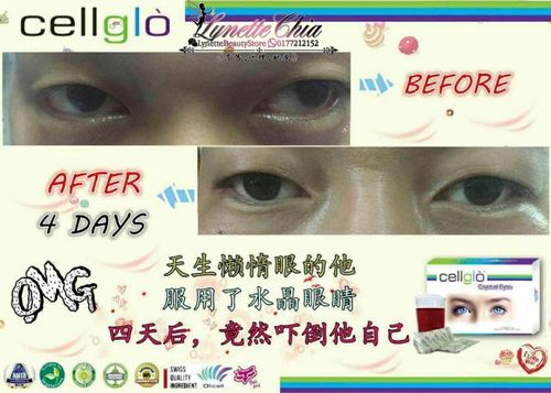 还你的孩子一双明亮的大眼睛  不需要害怕crystal eyes有什么化学成分