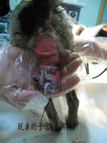 与死神擦肩而过的小花子宫脱垂