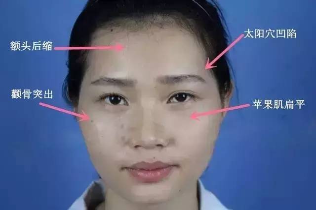 被嘲显老面相刻薄可她们居然用脂肪逆袭了