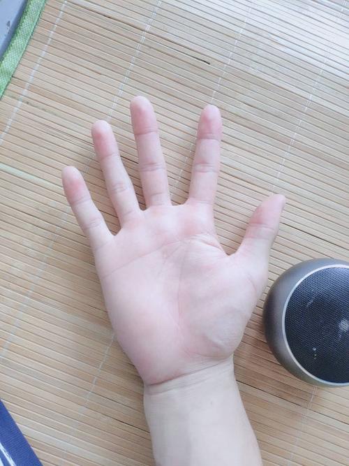 手指是不是骨质增生啊?