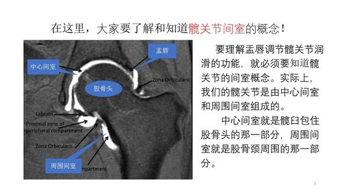初识髋关节盂唇