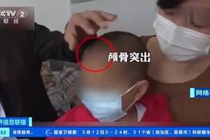 "大头娃娃"再现!三鹿奶粉事件后,假奶粉为何还在残害婴幼儿?