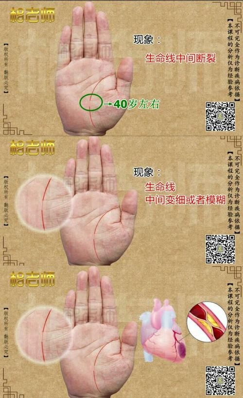 把整个生命线用80岁分,那此人呢,就在40到45岁左右会出现重大的疾病和