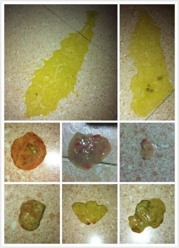 狗狗确诊细小了,这是入院前便便的照片.我想知道严重吗?