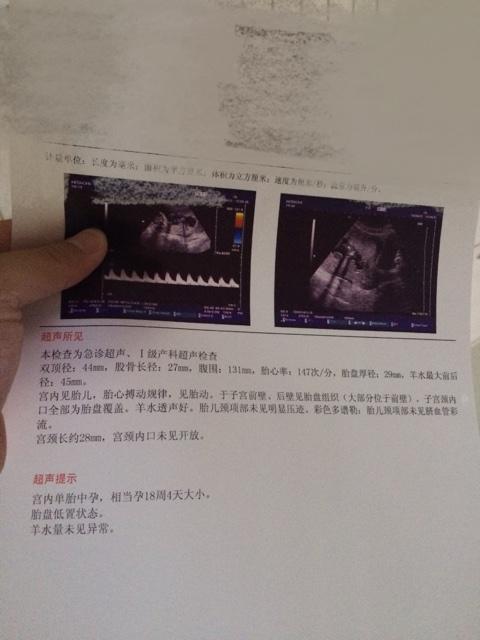 急!胎盘低置,胎盘覆盖宫颈口