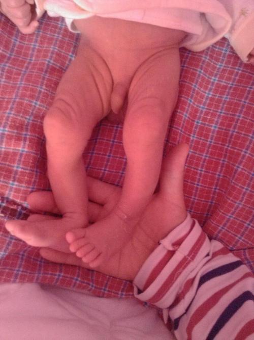 宝妈们宝宝腿型都什么样?