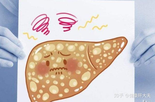 肝硬化导致的脾大该如何治疗?