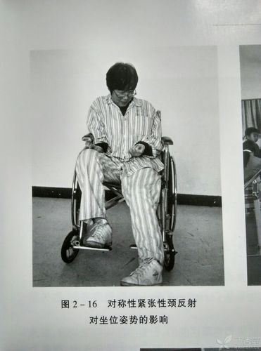 紧张性迷路反射与对称性紧张性颈反射?