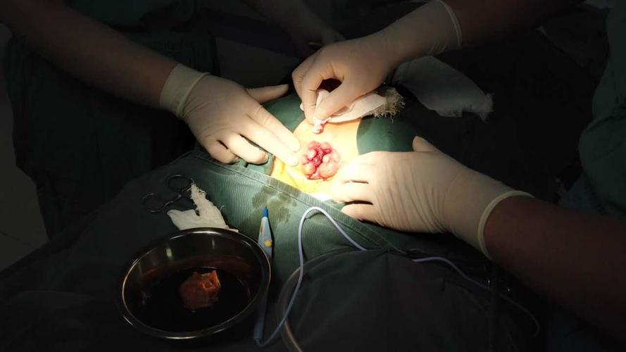 痔疮前后对比微创源于手术艺术