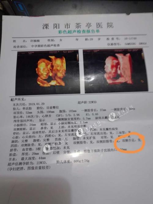这是茶亭医院的两张四维彩超检查单,求专业人士告诉我