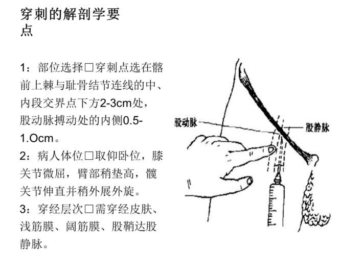股静脉穿刺术ppt012