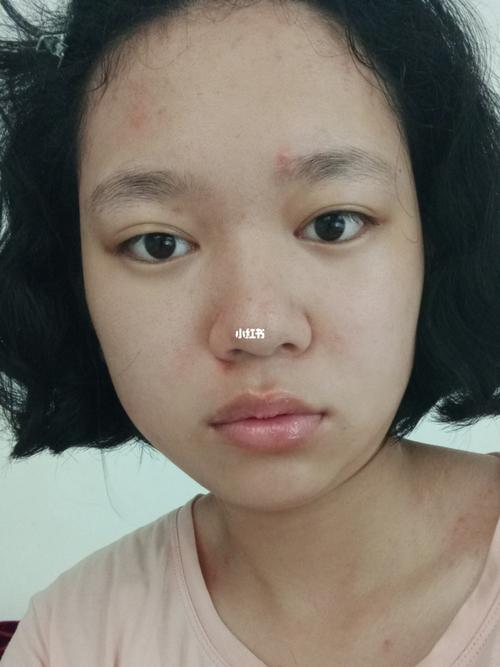15岁女孩素颜_素颜_容貌焦虑_反容貌焦虑_生活记录_接