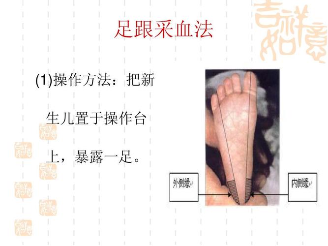 新生儿各种血标本的采集方法ppt