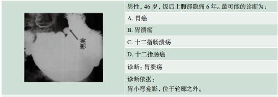 记忆:胃溃疡=龛影位于胃轮廓之外   龛影周围黏膜呈放射状(2)十二