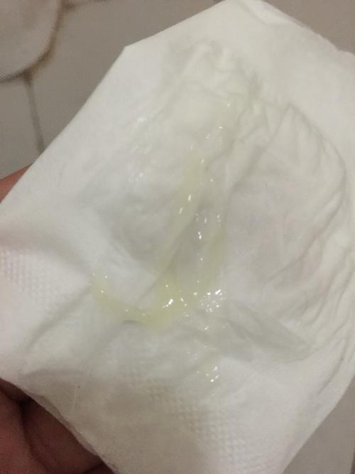 今天突然分泌物黄黄的跟鼻涕一样,有没有宝妈有一样的