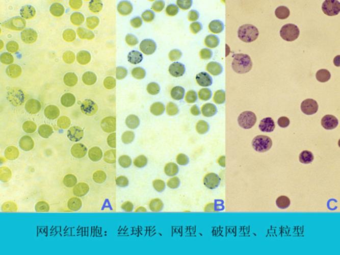 网织红细胞检测
