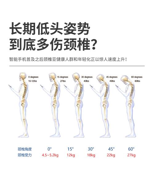 儿童颈托护颈椎固定家用理疗歪脖子前倾器偏头斜颈歪头纠正器儿童款l