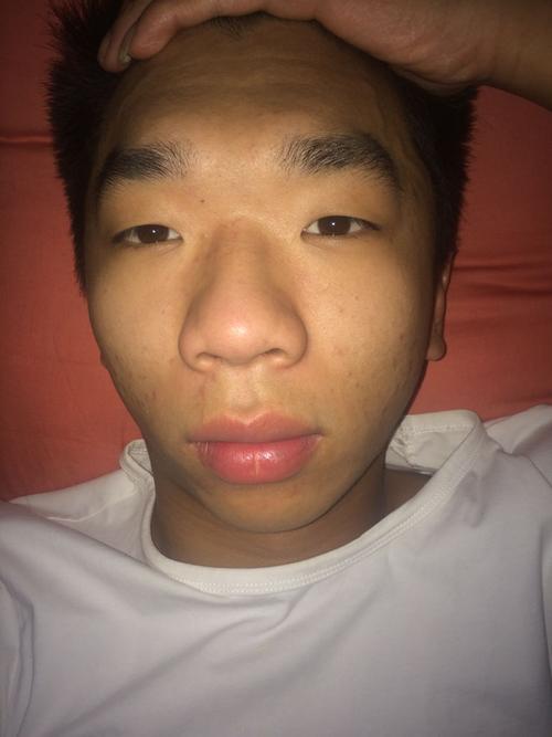 我的眉骨这样是不是太突出了