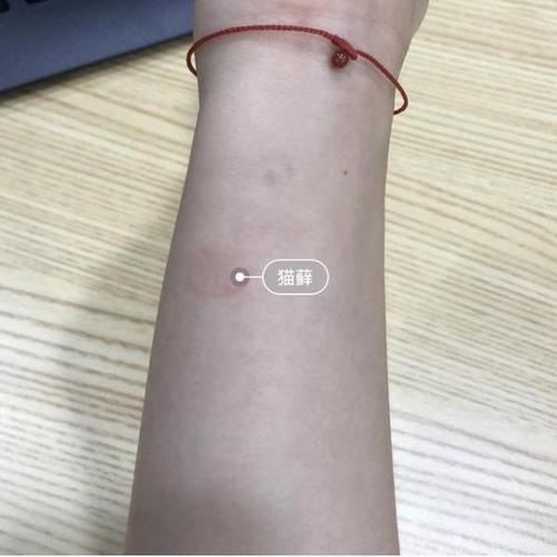 如何快速有效战胜猫藓,更能避免反反复复发作