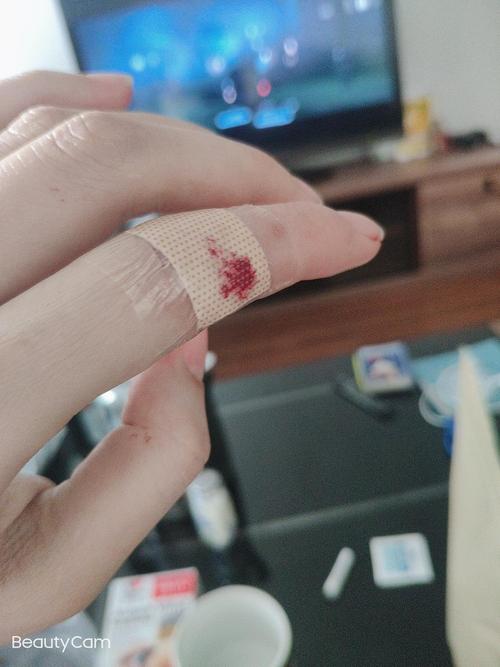 换第三个创可贴了,还是不停的渗出来.