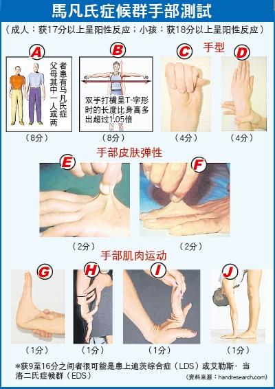 田老师,我爸爸就是马凡氏综合征去世的,那时候他35岁