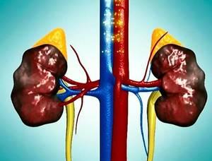 尿毒症的治疗方法有哪些呢 慢性肾衰会影响性功能吗?