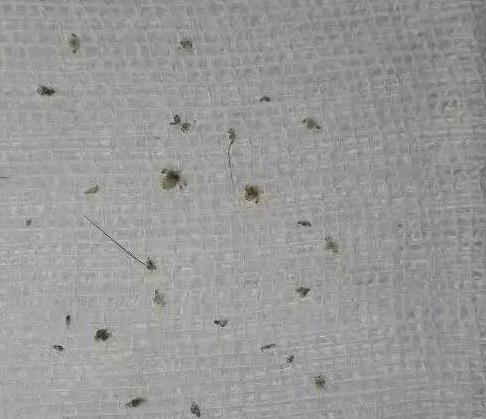最终在医生的精心治疗下,从小文的眼中共取出11只阴虱,虫卵更是达到了