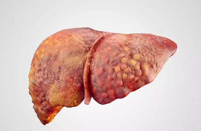 喝酒的同时也要保护肝脏,这样做!