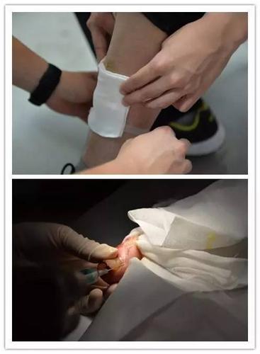 【生活帮】暴雨过后那些"绊脚"的事,帮你疗伤!_手机搜狐网