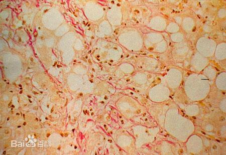 肝细胞图片_百度百科