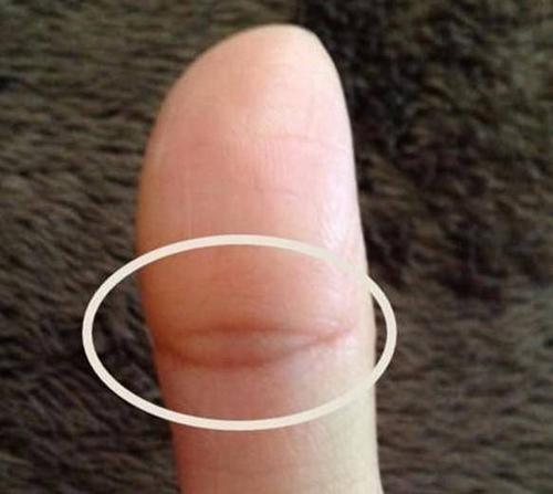 女人手上有凤尾纹之人