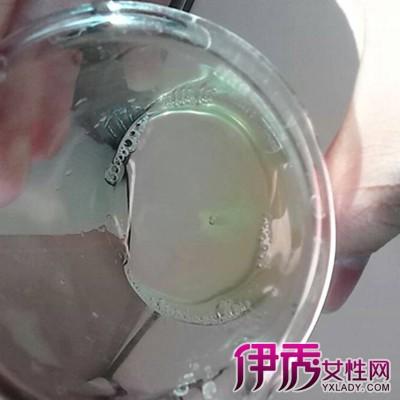 【图】前列腺液常规检查的各项参考值 告诉你前列腺的危害