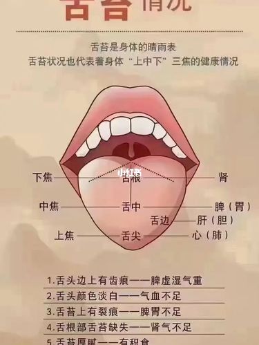 自己伸出舌头对照对照吧_舌苔_口臭_糖尿病_肠胃_胃炎