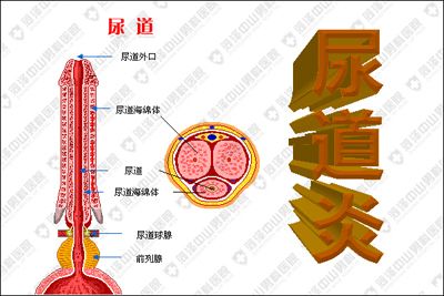 引发男性尿道炎的症状有哪些