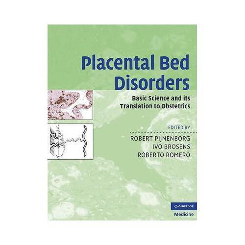 【预订】placental bed disorders: basic science and its