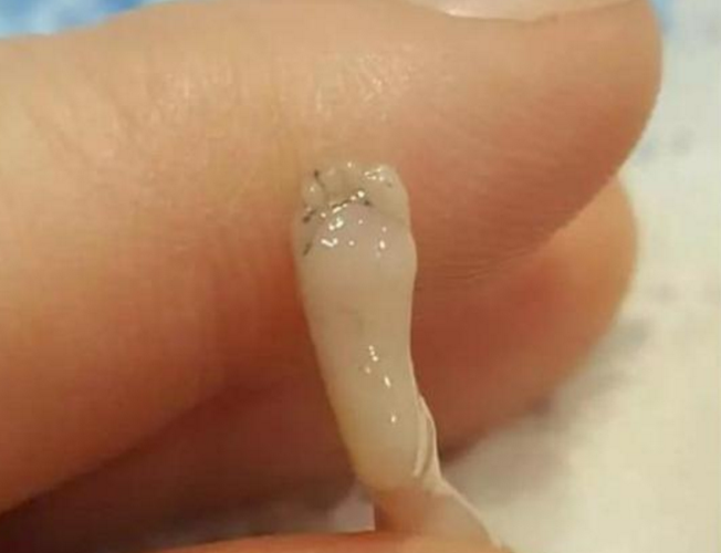 宝妈流产后将10cm胎儿放冰箱?还在网络晒照片劝孕妈们