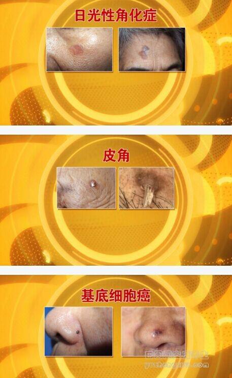 专家从一玲的浴室里揪出了癌症帮凶,这是一个家家户户都会用的东西